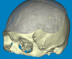 Photograph of medical modelling