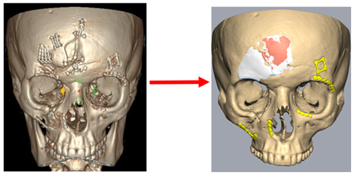 image of facial contour mapping 